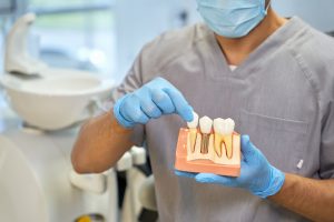 Dental Implants Offer